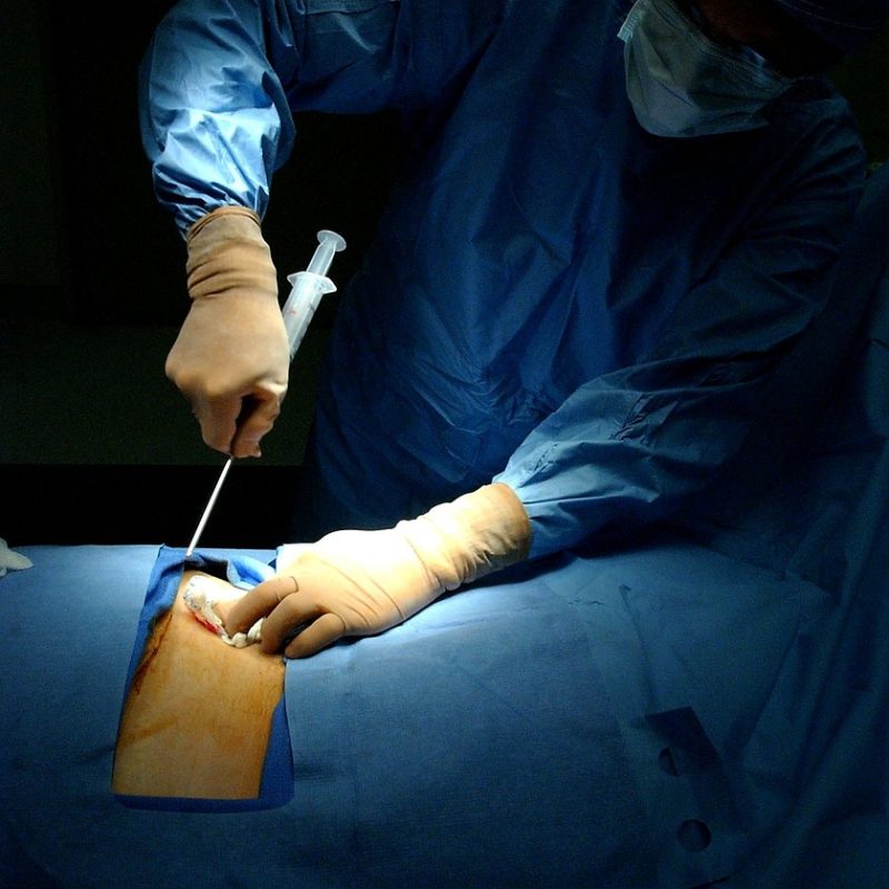 surgery-85574_1280